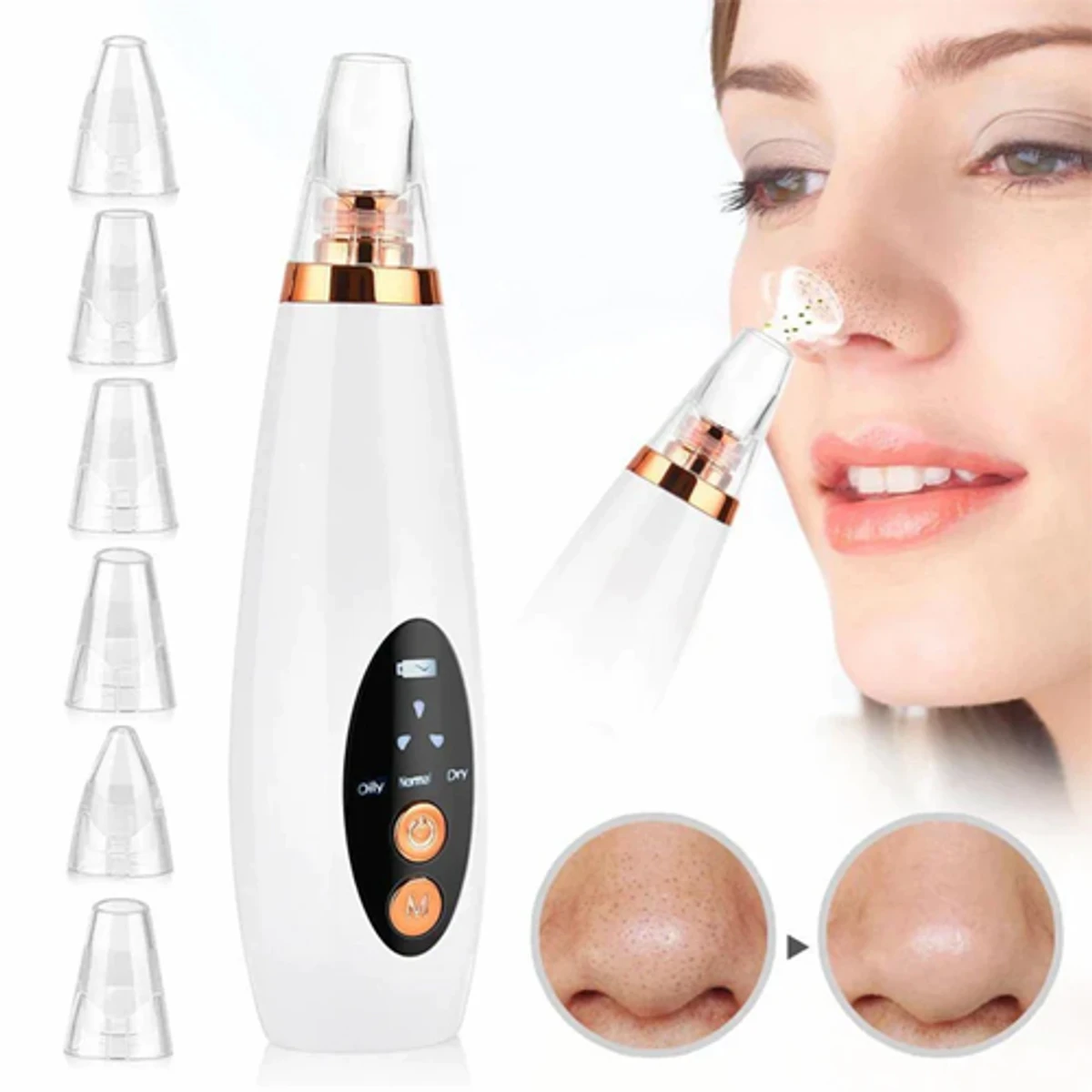 Blackhead Remover 6 In 1 Rechargeable