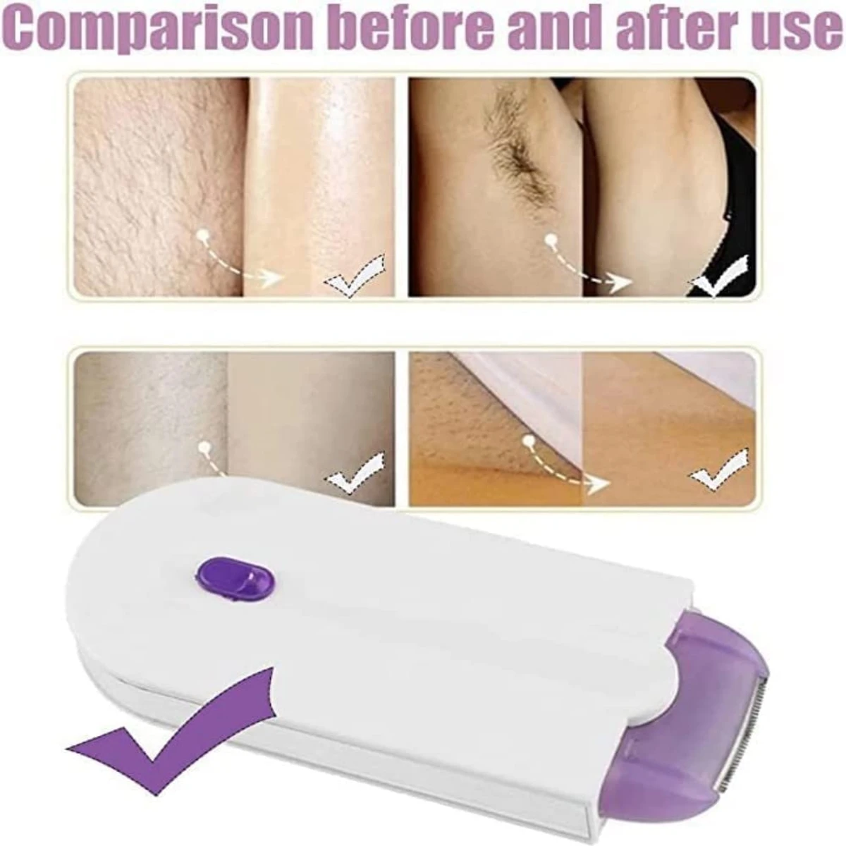 Smooth & Painless Hair Removal (Rechargeable Light Technology )